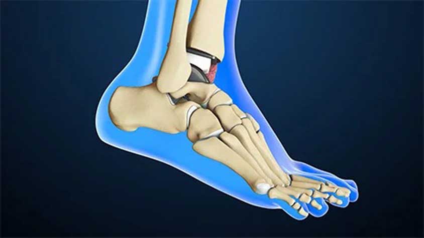آناتومی پا - استخوانهای پا